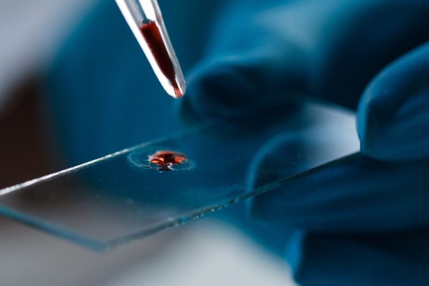 Blood Test ‘Clock’ Can Predict Alzheimer’s Symptoms Before They Emerge : ScienceAlert