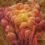 Cells in the body remember obesity. Here’s what that means for weight loss