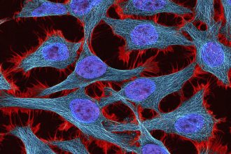 Estate of Henrietta Lacks settles with Novartis over immortal cells