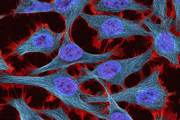 Estate of Henrietta Lacks settles with Novartis over immortal cells