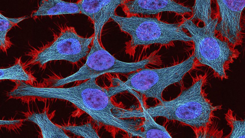 Estate of Henrietta Lacks settles with Novartis over immortal cells