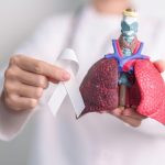 FDA clears Median Technologies’ lung nodule evaluation software