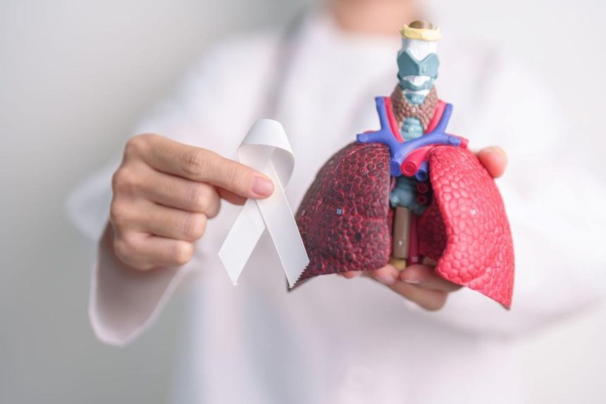 FDA clears Median Technologies’ lung nodule evaluation software