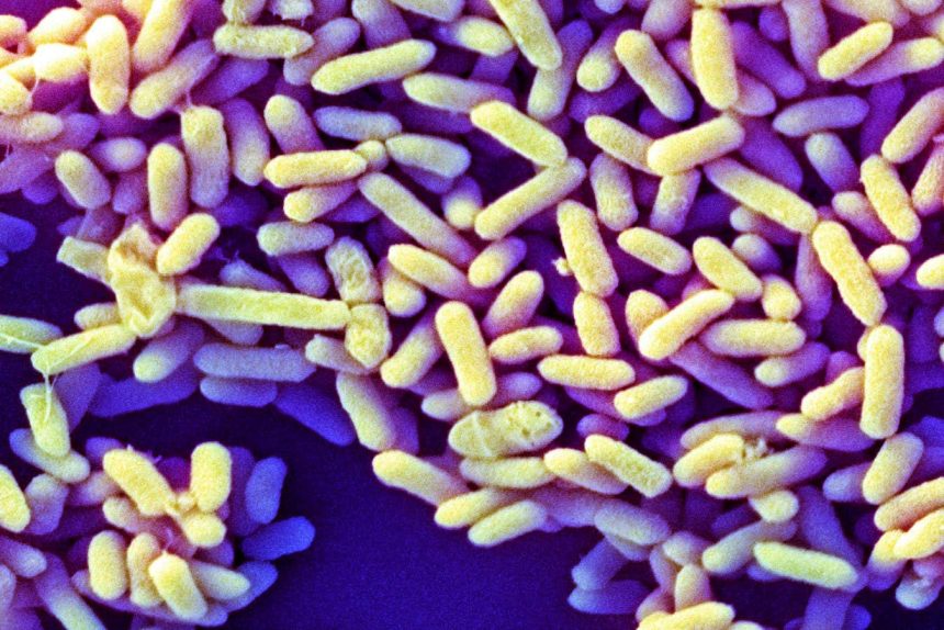 How baby microbiomes in the West differ from those everywhere else