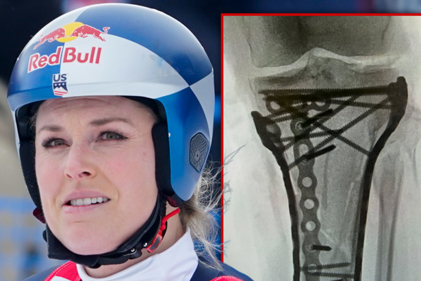 Lindsey Vonn ‘Struggling’ After Last Surgery, Remains Hospitalized in U.S.