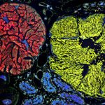 Microbe with the smallest genome yet pushes the boundaries of life