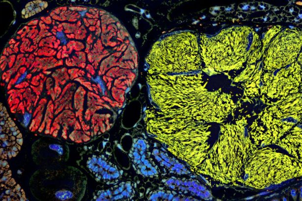 Microbe with the smallest genome yet pushes the boundaries of life