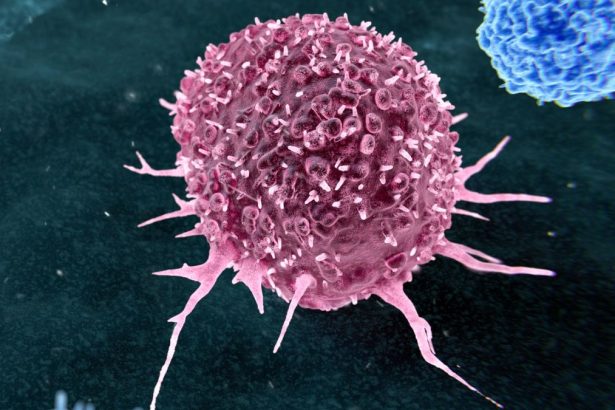 Most Preventable Cancers Are Linked to Just Two Lifestyle Habits : ScienceAlert