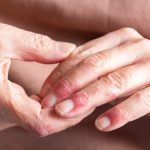 Roivant immune drug significantly outperformed placebo in treating rare skin disease