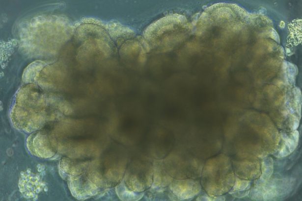 Scientists Grew Mini Brains, Then Trained Them to Solve an Engineering Problem : ScienceAlert