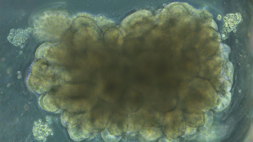 Scientists Grew Mini Brains, Then Trained Them to Solve an Engineering Problem : ScienceAlert