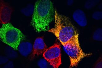 Scientists May Have Found The Key Cellular Process Behind Aging in Animals : ScienceAlert