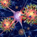 South Carolina measles outbreak is triggering dangerous brain swelling in some children