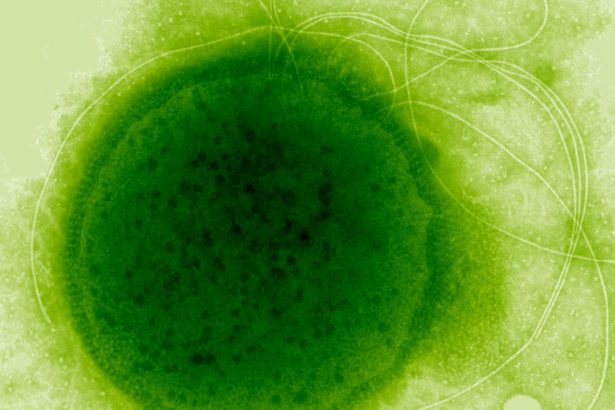 This Extreme Radiation-Resistant Organism Evolved a Remarkable Ability : ScienceAlert