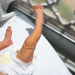 This baby sling turns sunlight into treatment for newborn jaundice