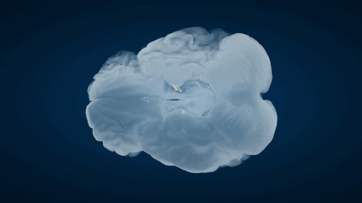 ‘Extraordinary’ brain network discovery changes our understanding of Parkinson’s disease