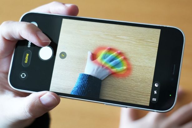 A Simple Photo of Your Hand Could Detect a Rare Health Disorder : ScienceAlert