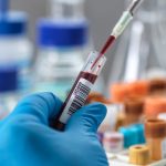 A newfound blood biomarker may one day predict longevity