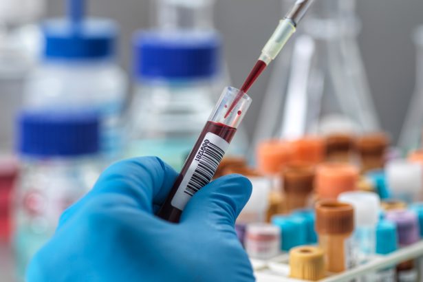 A newfound blood biomarker may one day predict longevity