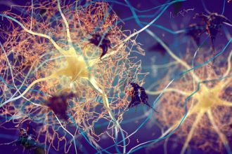 Alzheimer’s may start with inflammation in the skin, lungs or gut