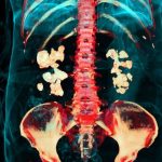 Bacteria Play Previously Unknown Role in Kidney Stones, Study Finds : ScienceAlert