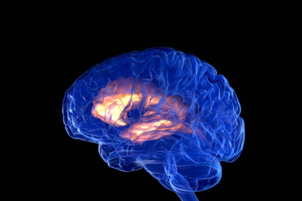 China just approved its first brain implant for commercial use, a world first