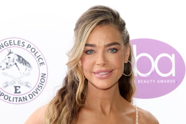 Denise Richards Reveals Before-and-After Facelift Photos