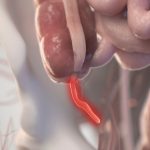 Evolution Keeps Reinventing The Appendix. Here’s Why It May Be Important. : ScienceAlert