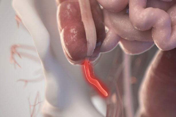 Evolution Keeps Reinventing The Appendix. Here’s Why It May Be Important. : ScienceAlert