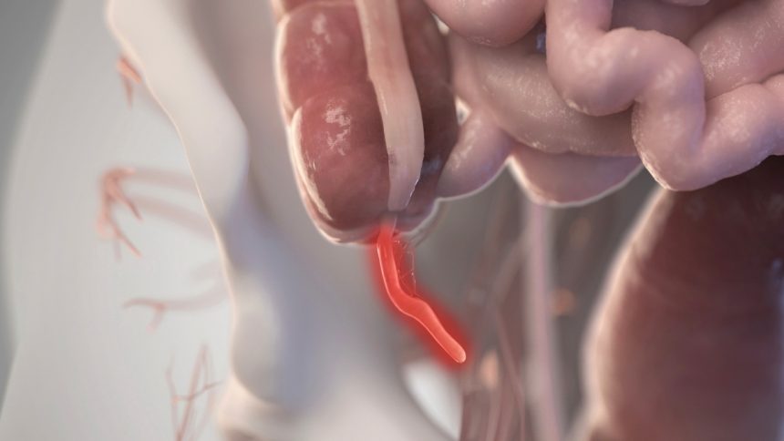 Evolution Keeps Reinventing The Appendix. Here’s Why It May Be Important. : ScienceAlert