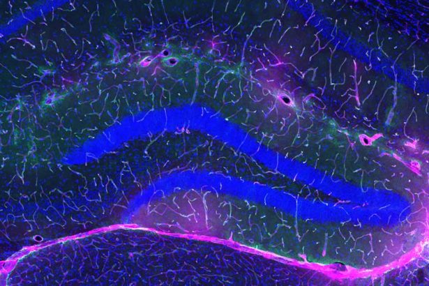 Exercise Protects Against Alzheimer’s, And Scientists May Finally Know Why : ScienceAlert