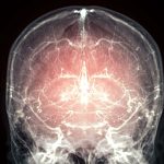 Major leap towards reanimation after death as mammal’s brain preserved