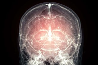 Major leap towards reanimation after death as mammal’s brain preserved