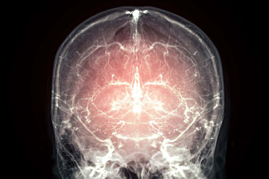 Major leap towards reanimation after death as mammal’s brain preserved