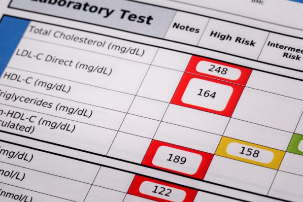 New heart disease guidelines suggest statins as early as age 30