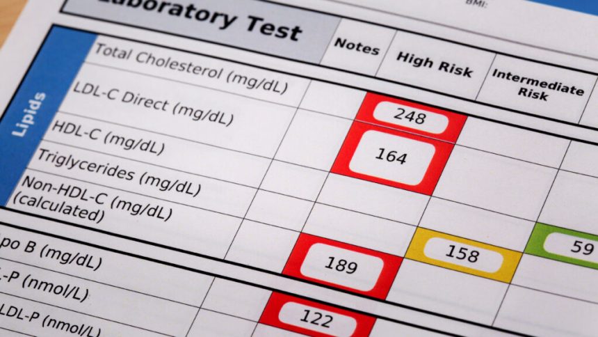 New heart disease guidelines suggest statins as early as age 30