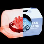 Organ transplant technology is advancing rapidly. So are the costs