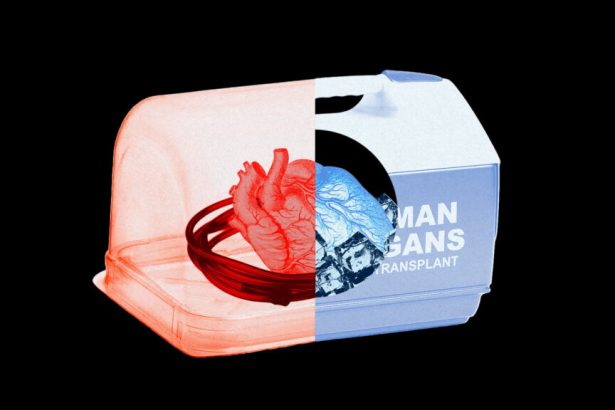 Organ transplant technology is advancing rapidly. So are the costs