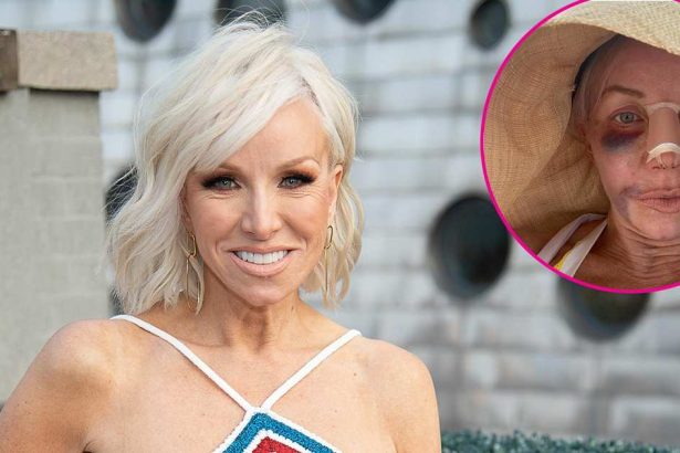 RHONJ Star Margaret Josephs Shows Off Nose Job Results