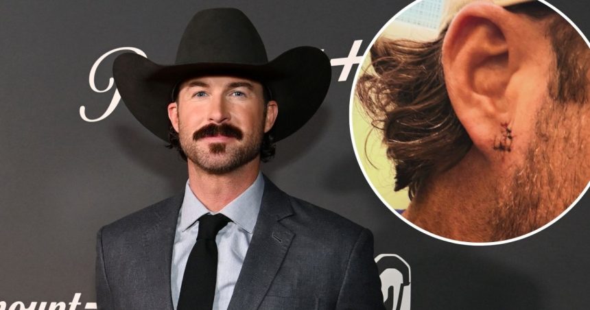 Riley Green Gets 5 Stitches After Fan Throws Phone at His Head