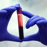 Rising CO2 Could Be Altering Our Blood Chemistry, Study Suggests : ScienceAlert