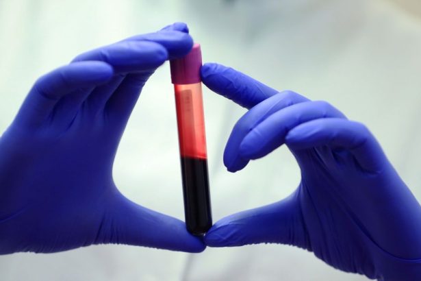 Rising CO2 Could Be Altering Our Blood Chemistry, Study Suggests : ScienceAlert