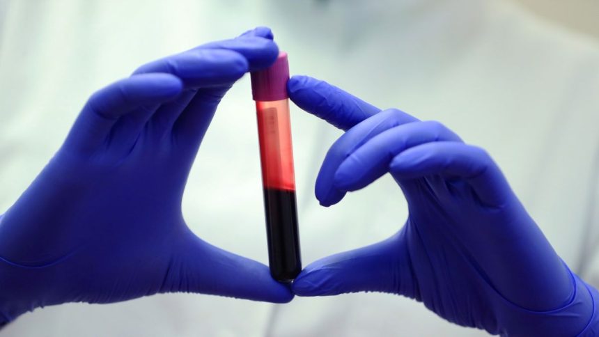 Rising CO2 Could Be Altering Our Blood Chemistry, Study Suggests : ScienceAlert