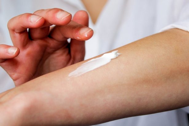 Scientists Uncover The Nerve Pathway That Makes Stress Worsen Eczema : ScienceAlert