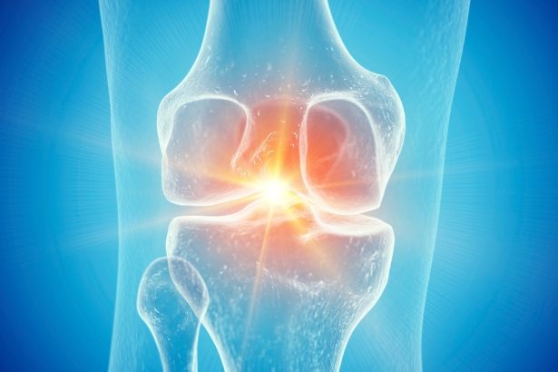 Semaglutide May Reverse Damage Caused by Osteoarthritis, Study Suggests : ScienceAlert