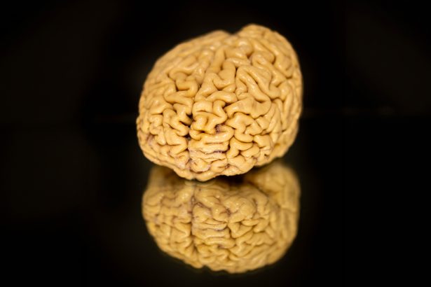 The remarkable brains of ‘SuperAgers’ hold clues about how we age