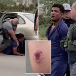 Vile photo shows gruesome bite mark on ICE officer after alleged Tren de Aragua gangster attacked him