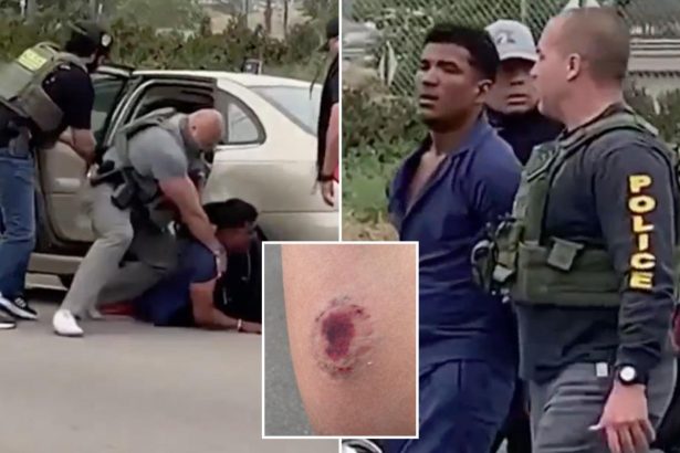 Vile photo shows gruesome bite mark on ICE officer after alleged Tren de Aragua gangster attacked him