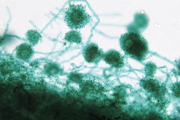 What We Know About The Fungus Behind Hospital Deaths : ScienceAlert