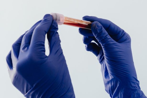 Women in Space Could Face a Hidden Blood-Clot Risk, Study Suggests : ScienceAlert